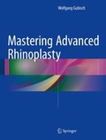 Cover: Mastering Advanced Rhinoplasty - Springer