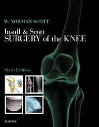 Abbildung von: Insall & Scott Surgery of the Knee E-Book - Elsevier