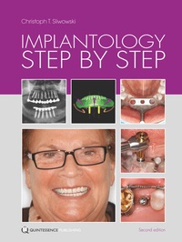 Abbildung von: Implantology Step by Step - Quintessenz Verlag