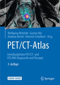 Abbildung von: PET/CT-Atlas - Springer