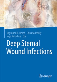Bild: Deep Sternal Wound Infections - Springer