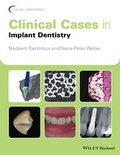 Cover: Clinical Cases in Implant Dentistry - Wiley-Blackwell