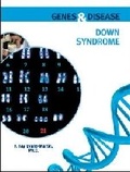 Cover: Down Syndrome - Chelsea House Publishers