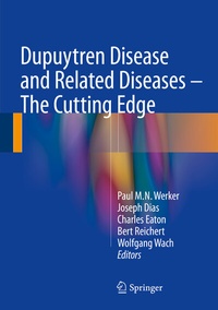 Abbildung von: Dupuytren Disease and Related Diseases - The Cutting Edge - Springer
