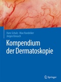 Cover: Kompendium der Dermatoskopie - Springer