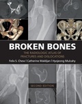 Cover: Broken Bones - Cambridge University Press