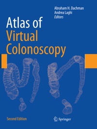 Abbildung von: Atlas of Virtual Colonoscopy - Springer