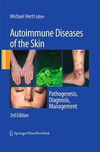 Bild vergrößern Bild: Autoimmune Diseases of the Skin - Springer