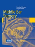 Cover: Middle Ear Surgery - Springer