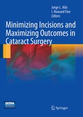 Cover: Minimizing Incisions and Maximizing Outcomes in Cataract Surgery - Springer