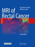 Cover: MRI of Rectal Cancer - Springer