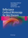Cover: Reflectance Confocal Microscopy for Skin Diseases - Springer