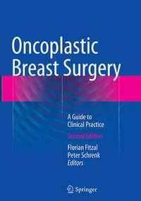 Bild vergrößern Bild: Oncoplastic Breast Surgery - Springer