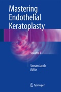 Cover: Mastering Endothelial Keratoplasty - Springer