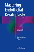 Cover: Mastering Endothelial Keratoplasty - Springer