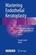 Cover: Mastering Endothelial Keratoplasty - Springer