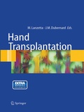 Cover: Hand transplantation - Springer