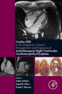 Abbildung von: Cardiac MRI in Diagnosis, Clinical Management, and Prognosis of Arrhythmogenic Right Ventricular Cardiomyopathy/Dysplasia - Academic Press