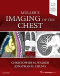 Cover: Muller's Imaging of the Chest - Elsevier