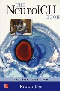 Abbildung von: The NeuroICU Book, Second Edition - McGraw-Hill Inc.,US