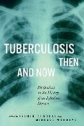Cover: Tuberculosis Then and Now - McGill-Queen's University Press