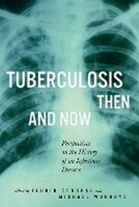 Enlarge image Cover: Tuberculosis Then and Now - McGill-Queen's University Press