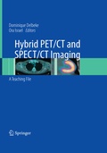 Cover: Hybrid PET/CT and SPECT/CT Imaging - Springer