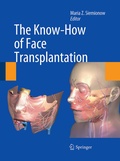 Cover: The Know-How of Face Transplantation - Springer