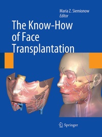 Enlarge image Cover: The Know-How of Face Transplantation - Springer