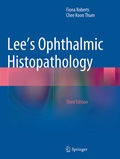 Cover: Lee's Ophthalmic Histopathology - Springer