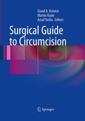 Cover: Surgical Guide to Circumcision - Springer