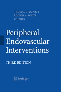 Abbildung von: Peripheral Endovascular Interventions - Springer
