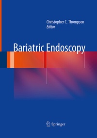 Abbildung von: Bariatric Endoscopy - Springer