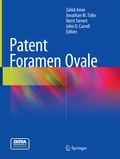 Cover: Patent Foramen Ovale - Springer