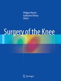 Cover: Surgery of the Knee - Springer