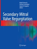 Bild: Secondary Mitral Valve Regurgitation - Springer