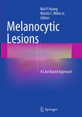Cover: Melanocytic Lesions - Springer