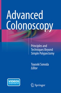 Abbildung von: Advanced Colonoscopy - Springer