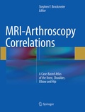 Cover: MRI-Arthroscopy Correlations - Springer