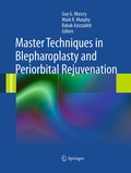 Cover: Master Techniques in Blepharoplasty and Periorbital Rejuvenation - Springer