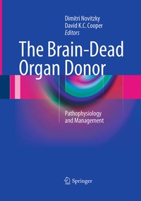 Abbildung von: The Brain-Dead Organ Donor - Springer