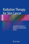 Cover: Radiation Therapy for Skin Cancer - Springer