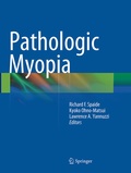 Cover: Pathologic Myopia - Springer
