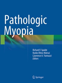 Enlarge image Cover: Pathologic Myopia - Springer
