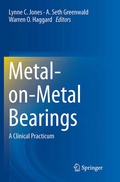 Cover: Metal-on-Metal Bearings - Springer