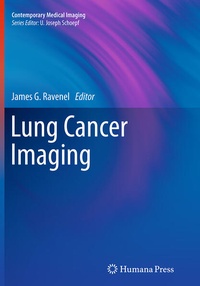 Enlarge image Cover: Lung Cancer Imaging - Humana Press Inc.