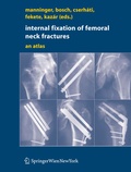 Cover: Internal fixation of femoral neck fractures - Springer
