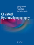 Cover: CT Virtual Hysterosalpingography - Springer