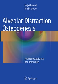 Abbildung von: Alveolar Distraction Osteogenesis - Springer