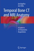 Cover: Temporal Bone CT and MRI Anatomy - Springer